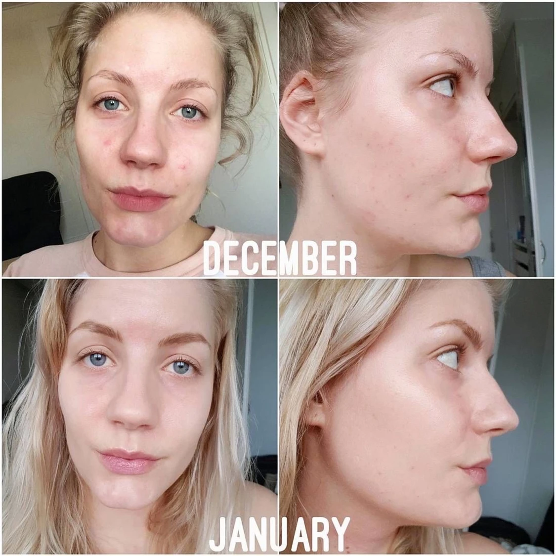 niacinamide 10% + zink 1% - 91