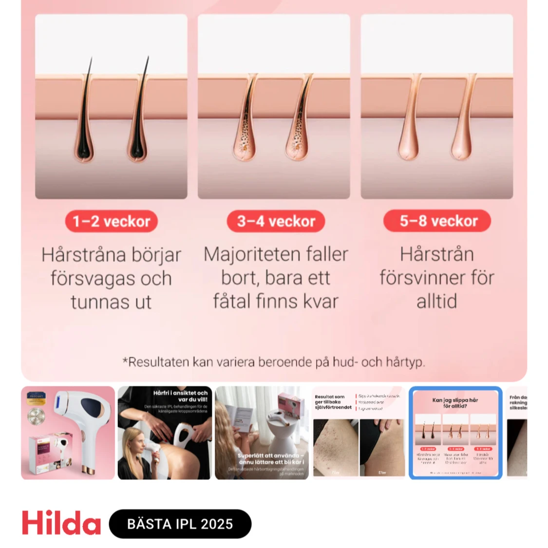 Hilda IPL Permanent Hair Removal Device - 3