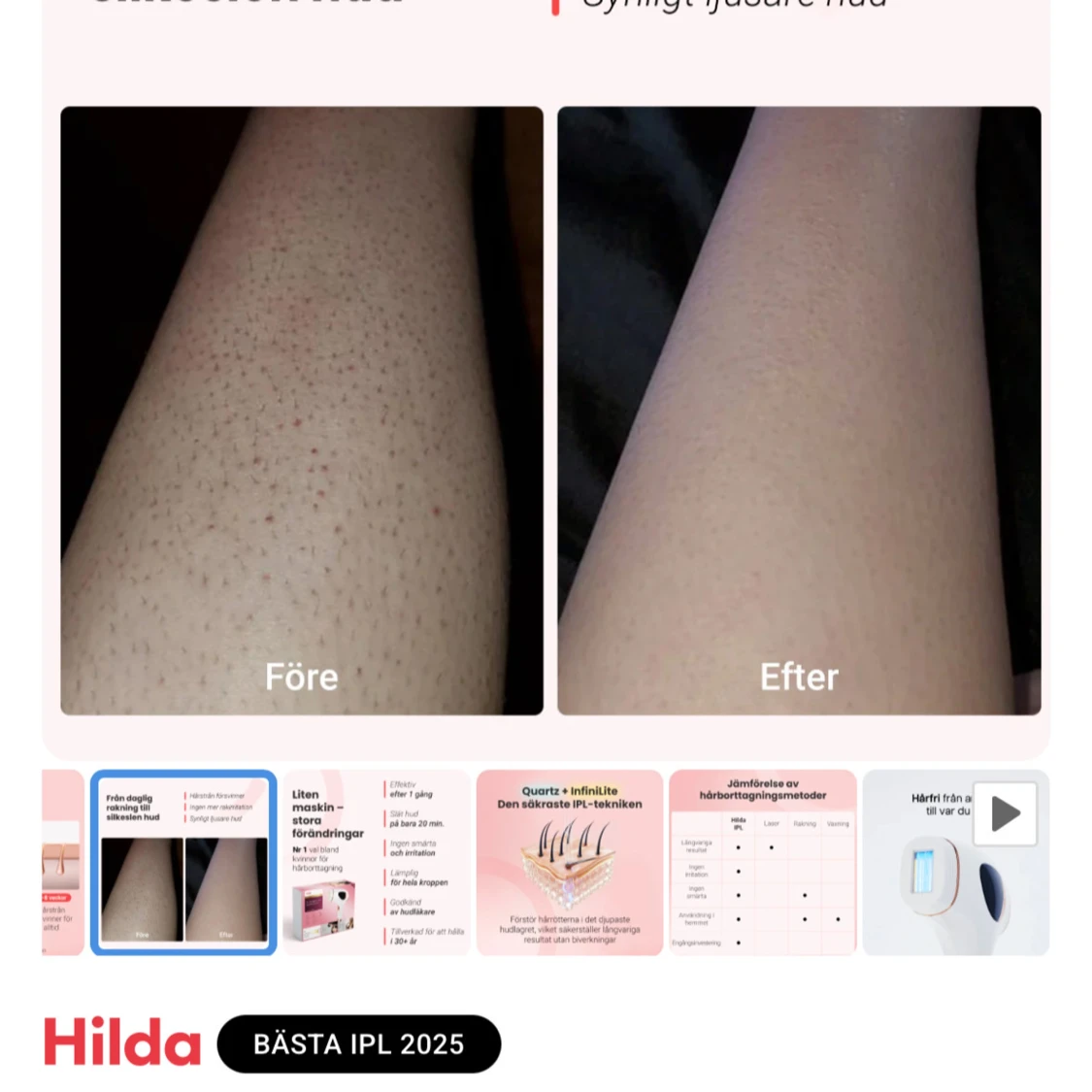 Hilda IPL Permanent Hair Removal Device - 4