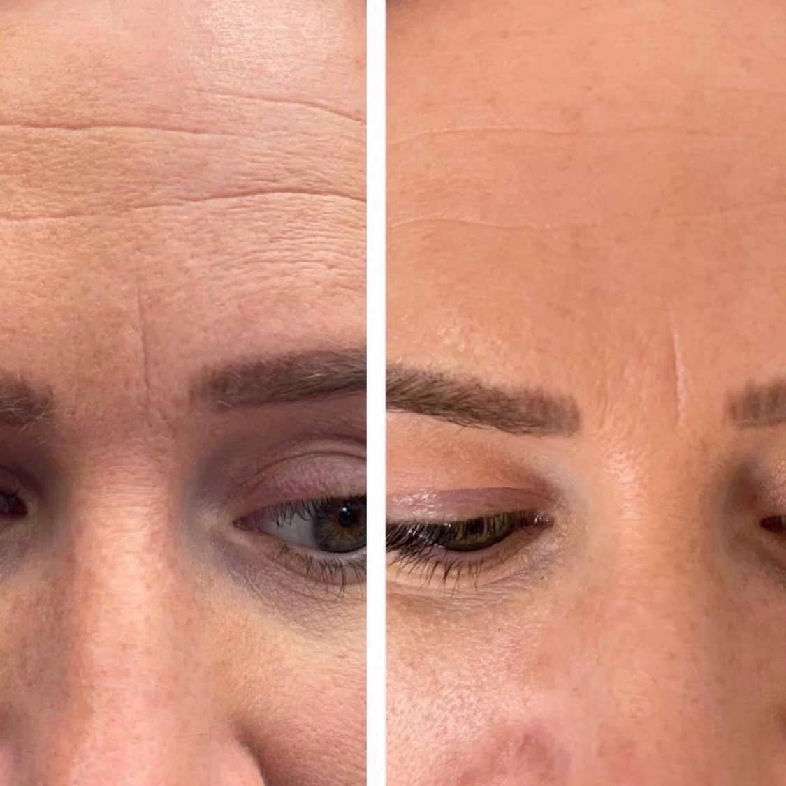 Kollagen Shot (Kosttillskott) - 91