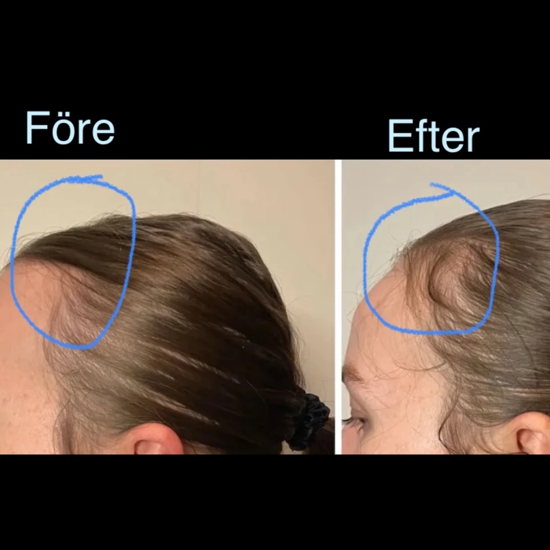 Hair Growth Oil  - 92