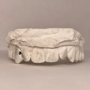 Custom Grillz - Custom Grillz & Jewelry Mer information och priser finns på instagram @grillz_sthlm