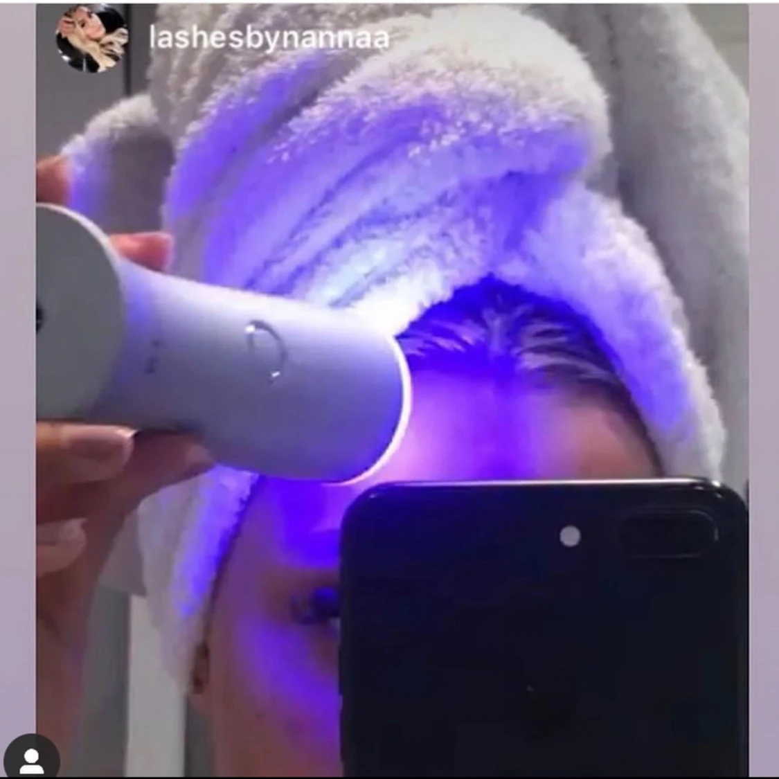 REGEN BLUE - Acne Treatment for all skins  - 92