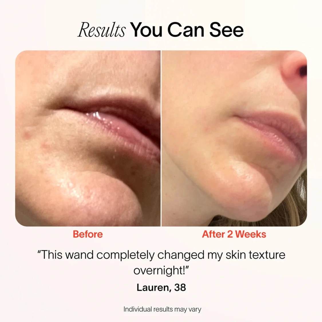 Infraredlight stav! - 92