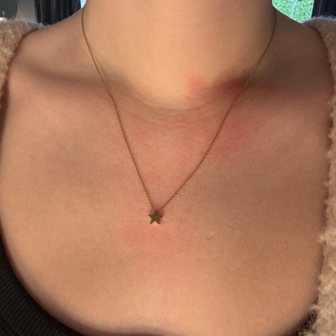 Halsband med stjärna Edblad  - 2