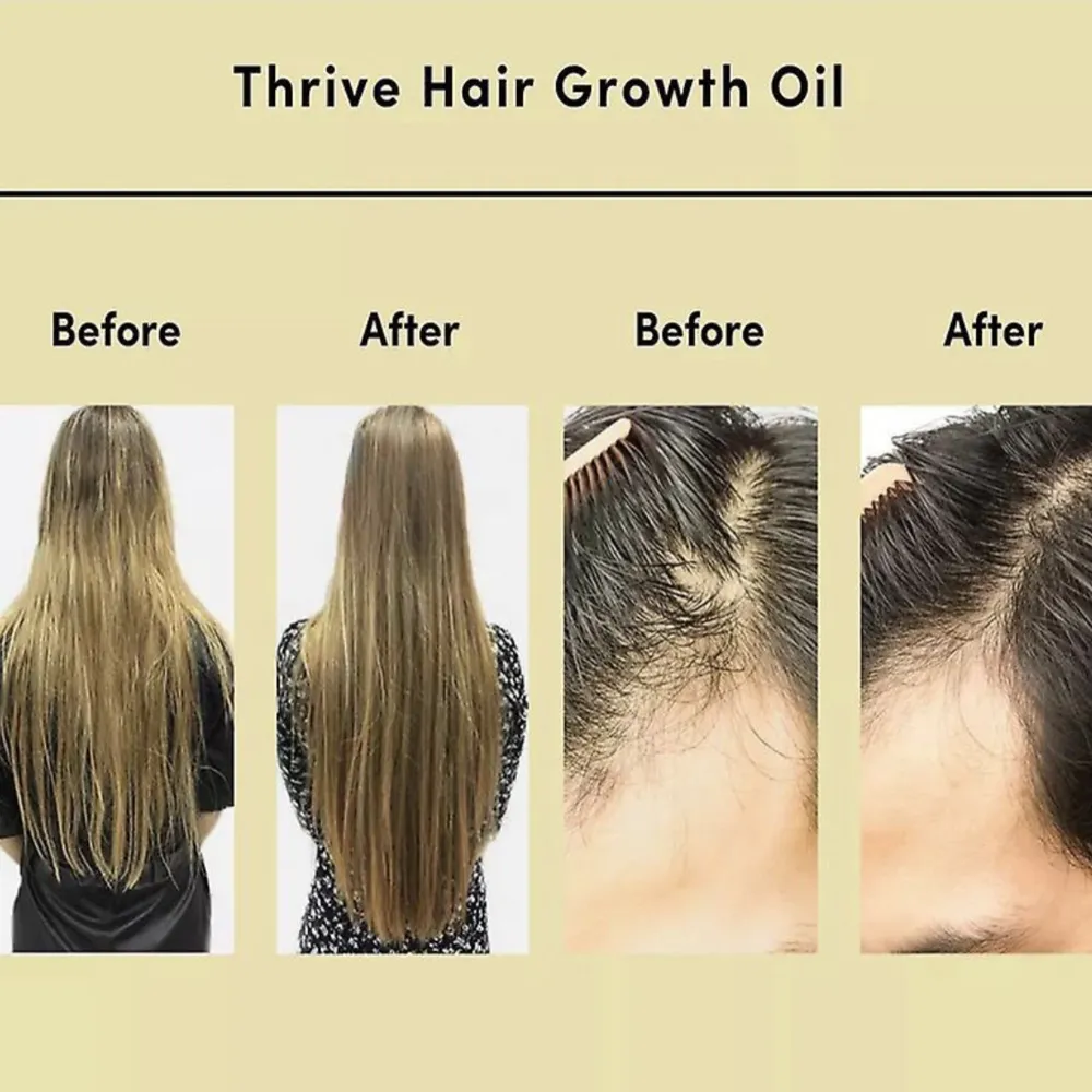 Super bra hår olja som gör håret tjockare och så att håret skiner mer💕innehåller många bra ingredienser så som rosmarins olja och mycket mer! råkade köpa två så denna är oanvänd💕 (trendig på tiktok). Övrigt.