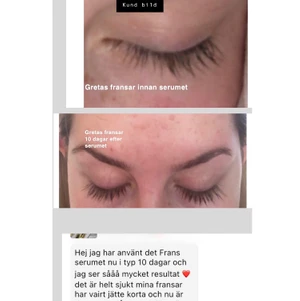 Fransolja - Naturlig fransolja som stimulerar hårväxten och ger längre och fylligare fransar (kan även användas på ögonbrynen). Resutat ser man efter ca 2-4 veckor. Flaskan innehåller totalt 10ml av 4 olika organiska oljor och räcker i 3-4 månader. Fransoljan kostar 99kr styck