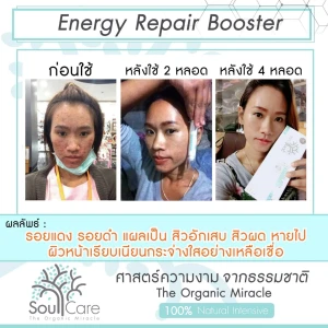  - Booster Concentrate innehålle stamceller från Rose placenta🌹🍃✨ och det är 100% från naturen utan kemikalier. Tillför fördelarna med cellulär reparation i över tusentals år. Med värdet av effektiva ingredienser stärker det huden. Smootha huden och minska röda fläckar. Mjuka upp och förbättra förmågan att ta bort gamla hudceller. Gör huden elastisk genom att bilda kollagen under huden mycket bättre än vitamin A och det finns mer antioxidant än vitamin C. Högre än placentan. Hjälper till att strama huden för att se mer frisk ut