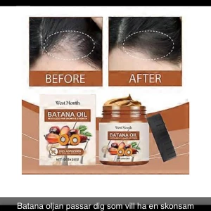 Batana oil  - Batana oljan passar dig som vill ha en skonsam lösning för tunt hår, långsam hårväxt och håravfall, samt har känslig hårbotten Vår batanaolja är framtagen för att ge ditt hår en estetisk förbättring, öka glansen, har några. 
