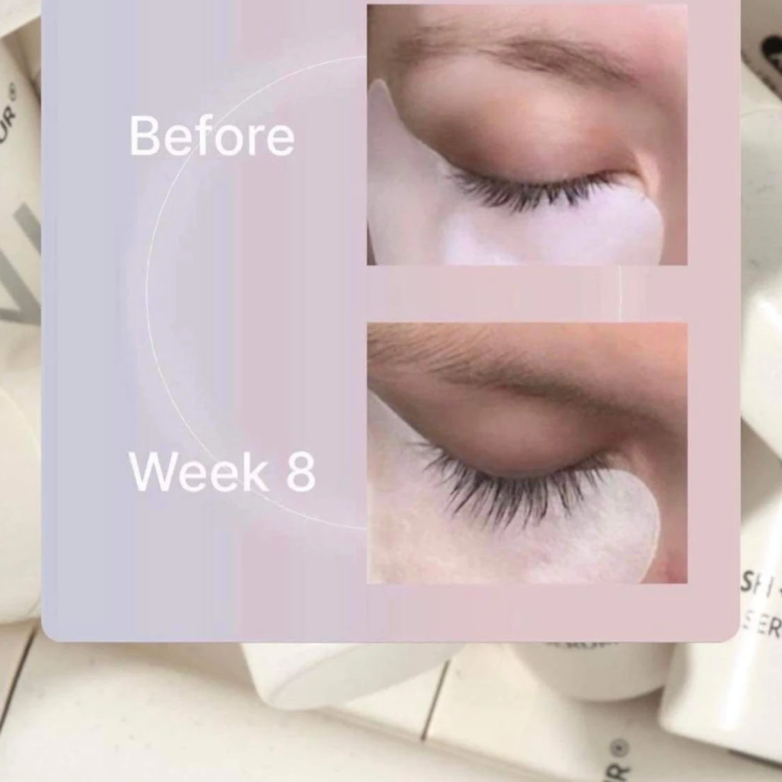 Frans o bryn serum  - 91