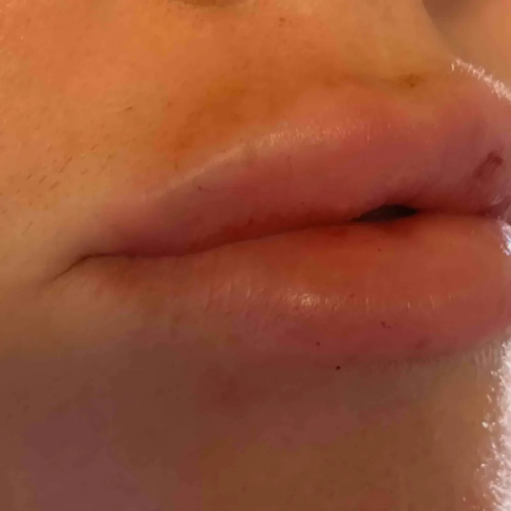 Skönhetsklinik i Rosersberg, mot Märsta. Allt ifrån Lashlift till fillers och microblading. Jag är mycket billigare än andra salonger :) tex 1000kr för microblading, 1500kr för 1,1 ml filler. Välkommen! Mvh Malin . Muu.