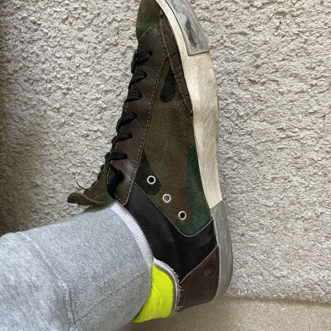 Philippe model  - 91