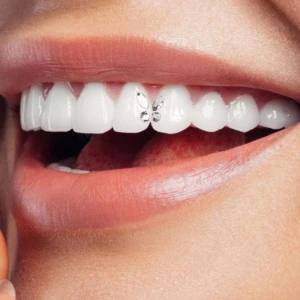 Twinkles tandkristall fjäril - Säljer en Twinkles tandkristall i form av en fjäril, perfekt för att ge ditt leende extra bling. Kristallerna är klara och glittriga och fästs direkt på tanden. Setet innehåller fyra stenar som tillsammans bildar en snygg fjärilsform.