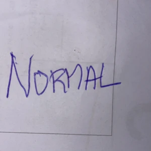 Klänning spets - underklänning fastsydd  - Spets klänning normal passform fast passar en medium storlek köpt vis Nelly.com men tyckte den var för lång för mig ( har ej i svart som jag förkortat blev fint. Köpt 2020 Nypris 499 kr