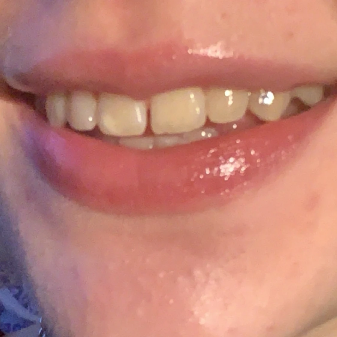 Swarovski tandsmycken - 90